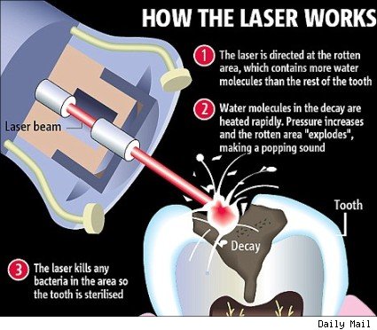 Laser Lorain, OH Dentist